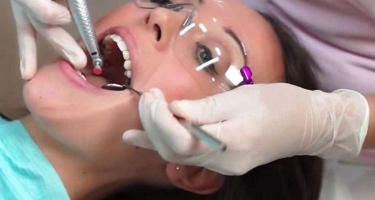 Limpeza dental e remoção de tártaro